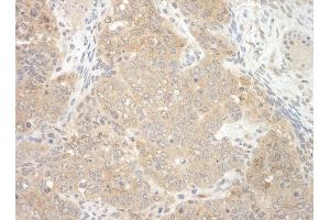 Immunohistochemistry (IHC) image for anti-E3 ubiquitin-protein ligase NEDD4-like (NEDD4L) (AA 275-325) antibody (ABIN7448685) (NEDD4-2 Antikörper  (AA 275-325))