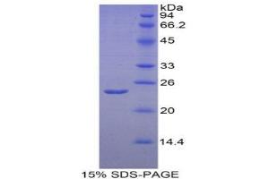SDS-PAGE (SDS) image for Endothelial PAS Domain Protein 1 (EPAS1) (AA 339-541) protein (His tag) (ABIN1877550) (EPAS1 Protein (AA 339-541) (His tag))