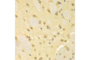 Immunohistochemistry of paraffin-embedded rat brain using SMAD1 antibody (ABIN5970455) at dilution of 1/100 (40x lens).