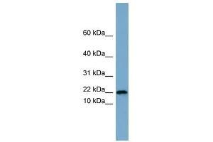 PRR13 antibody used at 1 ug/ml to detect target protein. (Proline Rich 13 Antikörper  (Middle Region))