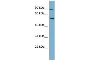 WB Suggested Anti-MFSD1 Antibody Titration:  0. (MFSD1 Antikörper  (Middle Region))