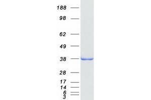 Western Blotting (WB) image for ADP-Ribosylhydrolase Like 2 (ADPRHL2) protein (Myc-DYKDDDDK Tag) (ABIN2714434)