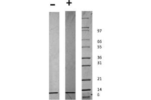 SDS-PAGE of Human Beta-cell Attracting Chemokine 1 (CXCL13) Recombinant Protein SDS-PAGE of Human Beta-cell Attracting Chemokine 1 (CXCL13) Recombinant Protein. (CXCL13 Protein)