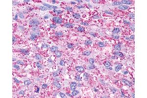 Immunohistochemistry (IHC) image for anti-Purinergic Receptor P2Y, G-Protein Coupled, 13 (P2RY13) (Extracellular Domain) antibody (ABIN1049210)