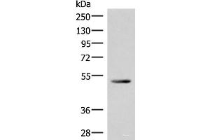 Western blot analysis of Mouse heart tissue lysate using IRX4 Polyclonal Antibody at dilution of 1:400