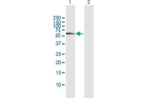 Western Blot analysis of BBS4 expression in transfected 293T cell line by BBS4 MaxPab polyclonal antibody. (BBS4 Antikörper  (AA 1-519))