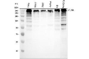Western blot analysis of Filamin A using anti-Filamin A antibody (ABIN7604854).