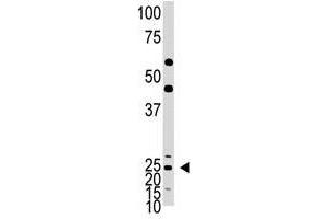 Image no. 1 for anti-Achaete-Scute Complex Homolog 1 (Drosophila) (ASCL1) (C-Term) antibody (ABIN357401) (ASCL1 Antikörper  (C-Term))