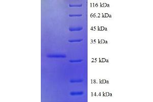 SDS-PAGE (SDS) image for S100 Calcium Binding Protein A6 (S100A6) (AA 1-90), (full length) protein (His-SUMO Tag) (ABIN5710298)