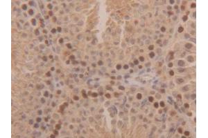 Used in DAB staining on fromalin fixed paraffin-embedded Kidney tissue (SOD1 Antikörper  (AA 2-154))