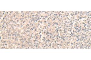 Immunohistochemistry of paraffin-embedded Human tonsil tissue using DDX59 Polyclonal Antibody at dilution of 1:30(x200) (DDX59 Antikörper)