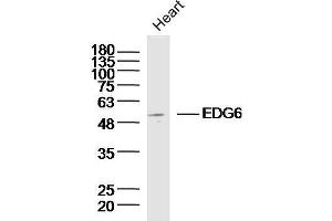 Mouse heart lysates probed with EDG6 Polyclonal Antibody, unconjugated  at 1:300 overnight at 4°C followed by a conjugated secondary antibody at 1:10000 for 90 minutes at 37°C. (S1PR4 Antikörper  (AA 301-384))