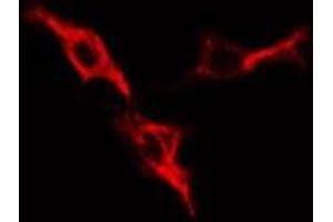 ABIN6276412 staining HepG2 cells by IF/ICC. (PRKAR1A Antikörper  (N-Term))