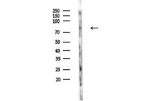 Western blot analysis of lysates from PC12 cells, using Phospho-YAP (Ser109) Antibody at 1/1000 dilution.