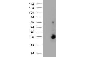 Image no. 2 for anti-Ubiquitin-Conjugating Enzyme E2E 3 (UBE2E3) antibody (ABIN1501622) (UBE2E3 Antikörper)