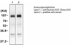 Image no. 1 for anti-Hepatocyte Growth Factor (Hepapoietin A, Scatter Factor) (HGF) antibody (ABIN331456) (HGF Antikörper)