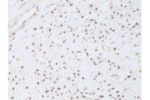 Immunohistochemistry (Paraffin-embedded Sections) (IHC (p)) image for anti-FK506 Binding Protein 4, 59kDa (FKBP4) (AA 220-459) antibody (ABIN6140658)