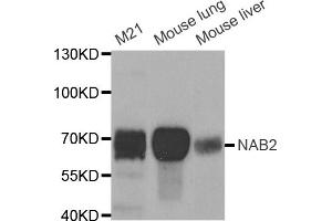 Western blot analysis of extracts of various cell lines, using NAB2 antibody (ABIN5973441) at 1/1000 dilution. (NAB2 Antikörper)