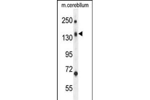 C Antibody (N-term) (ABIN654596 and ABIN2844295) western blot analysis in mouse cerebellum tissue lysates (35 μg/lane). (CD109 Antikörper  (N-Term))