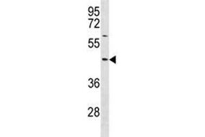TXNIP antibody western blot analysis in NCI-H292 lysate. (TXNIP Antikörper  (AA 1-30))