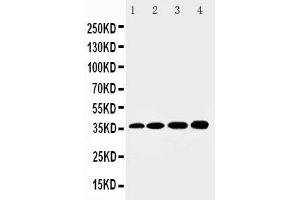 Anti-HSD17B1 antibody, Western blotting Lane 1: Rat Kidney Tissue Lysate Lane 2: Rat Liver Tissue Lysate Lane 3: 293T Cell Lysate Lane 4: HELA Cell Lysate (HSD17B1 Antikörper  (N-Term))