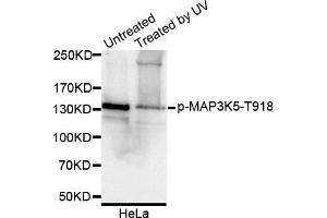Western Blotting (WB) image for anti-Mitogen-Activated Protein Kinase Kinase Kinase 5 (MAP3K5) (pThr918) antibody (ABIN6225427) (ASK1 Antikörper  (pThr918))