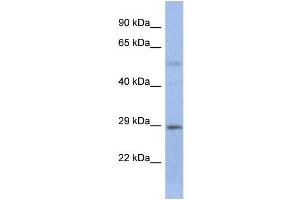 Host:  Rabbit  Target Name:  STEAP1B  Sample Type:  Fetal Small Intestine lysates  Antibody Dilution:  1. (STEAP1B Antikörper  (N-Term))
