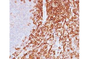 IHC staining of spleen with CD43 antibody (DF-T1). (CD43 Antikörper)
