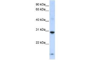 Western Blot showing ZNF138 antibody used at a concentration of 1-2 ug/ml to detect its target protein.