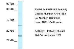 Western Blotting (WB) image for anti-Protein Phosphatase 1, Regulatory (Inhibitor) Subunit 2 (PPP1R2) (N-Term) antibody (ABIN2788785)