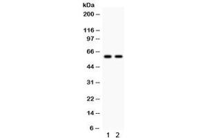 Western blot testing of 1) rat kidney and 2) human MCF7 lysate with CYP1B1 antibody. (CYP1B1 Antikörper  (AA 255-480))