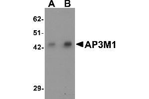 Western blot analysis of AP3M1 in human brain tissue lysate with AP3M1 antibody at (A) 1 and (B) 2 µg/mL . (AP3M1 Antikörper  (C-Term))