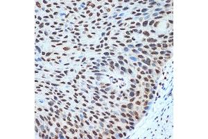 Immunohistochemistry (IHC) image for anti-Histone H2B Type 1-K (HIST1H2BK) antibody (ABIN7267736)