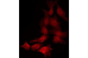 Immunofluorescence (fixed cells) (IF/ICC) image for anti-Janus Kinase 1 (JAK1) (pTyr1022), (pTyr1023) antibody (ABIN6255762)