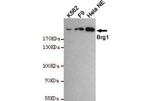 Western blot detection of BRG1 in Hela NE,F9 and K562 cell lysates using BRG1 mouse mAb (1:1000 diluted). (SMARCA4 Antikörper)