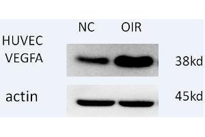 Western blot analysis of extracts of H460 cells, using antibody at 1:1000 dilution. (VEGFA Antikörper  (AA 1-147))