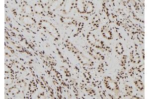 ABIN6272436 at 1/100 staining Human kidney tissue by IHC-P. (ELP2 Antikörper  (Internal Region))