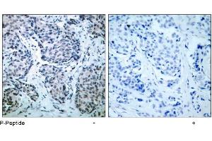 Image no. 1 for anti-Mitogen-Activated Protein Kinase Kinase 4 (MAP2K4) (pThr261) antibody (ABIN196908) (MAP2K4 Antikörper  (pThr261))