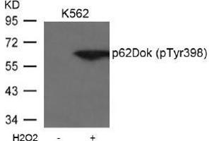 Image no. 2 for anti-Docking Protein 1, 62kDa (Downstream of tyrosine Kinase 1) (DOK1) (pTyr398) antibody (ABIN197042)