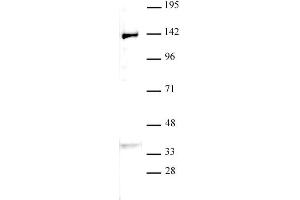 JMJD2B / KDM4B antibody (pAb) tested by Western blot. (KDM4B Antikörper  (C-Term))