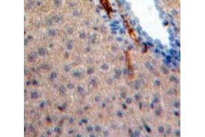 IHC-P analysis of Liver tissue, with DAB staining. (IL-31 Antikörper  (AA 28-154))
