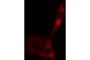 ABIN6269010 staining HeLa cells by IF/ICC. (HSPA9 Antikörper  (C-Term))