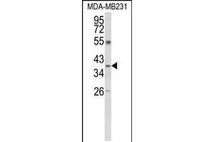 Western blot analysis of ARG1 Antibody in MDA-MB231 cell line lysates (35ug/lane) (Liver Arginase Antikörper  (C-Term))