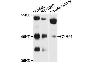 Western blot analysis of extracts of various cell lines, using CYR61 antibody (ABIN5970462) at 1/1000 dilution. (CYR61 Antikörper)