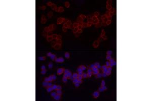 Immunofluorescence analysis of THP-1 cells using CD18 Rabbit pAb (ABIN3023117, ABIN3023118, ABIN3023119 and ABIN6219398) at dilution of 1:50 (40x lens).