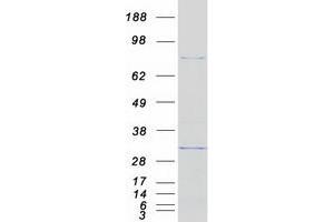 Western Blotting (WB) image for DEAD (Asp-Glu-Ala-Asp) Box Polypeptide 50 (DDX50) protein (Myc-DYKDDDDK Tag) (ABIN2719287)