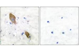 Immunohistochemistry analysis of paraffin-embedded human brain, using PYK2 (Phospho-Tyr881) Antibody.