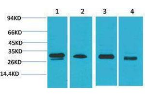 Western Blotting (WB) image for anti-Protein Kinase, AMP-Activated, beta 2 Non-Catalytic Subunit (PRKAB2) antibody (ABIN3179113)