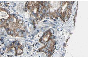 ABIN6276478 at 1/100 staining Human prostate tissue by IHC-P. (ACTR3 Antikörper  (C-Term))