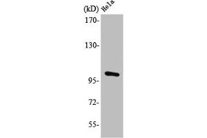 Western Blot analysis of HeLa cells using PMS2 Polyclonal Antibody (PMS2 Antikörper  (Internal Region))